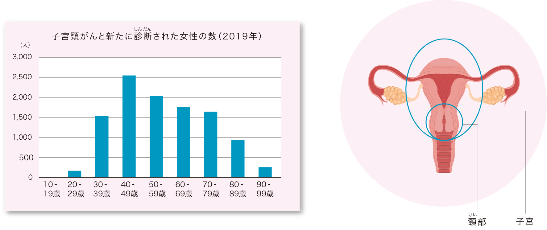 子宮頸がんと新たに診断された女性の数(2019年)