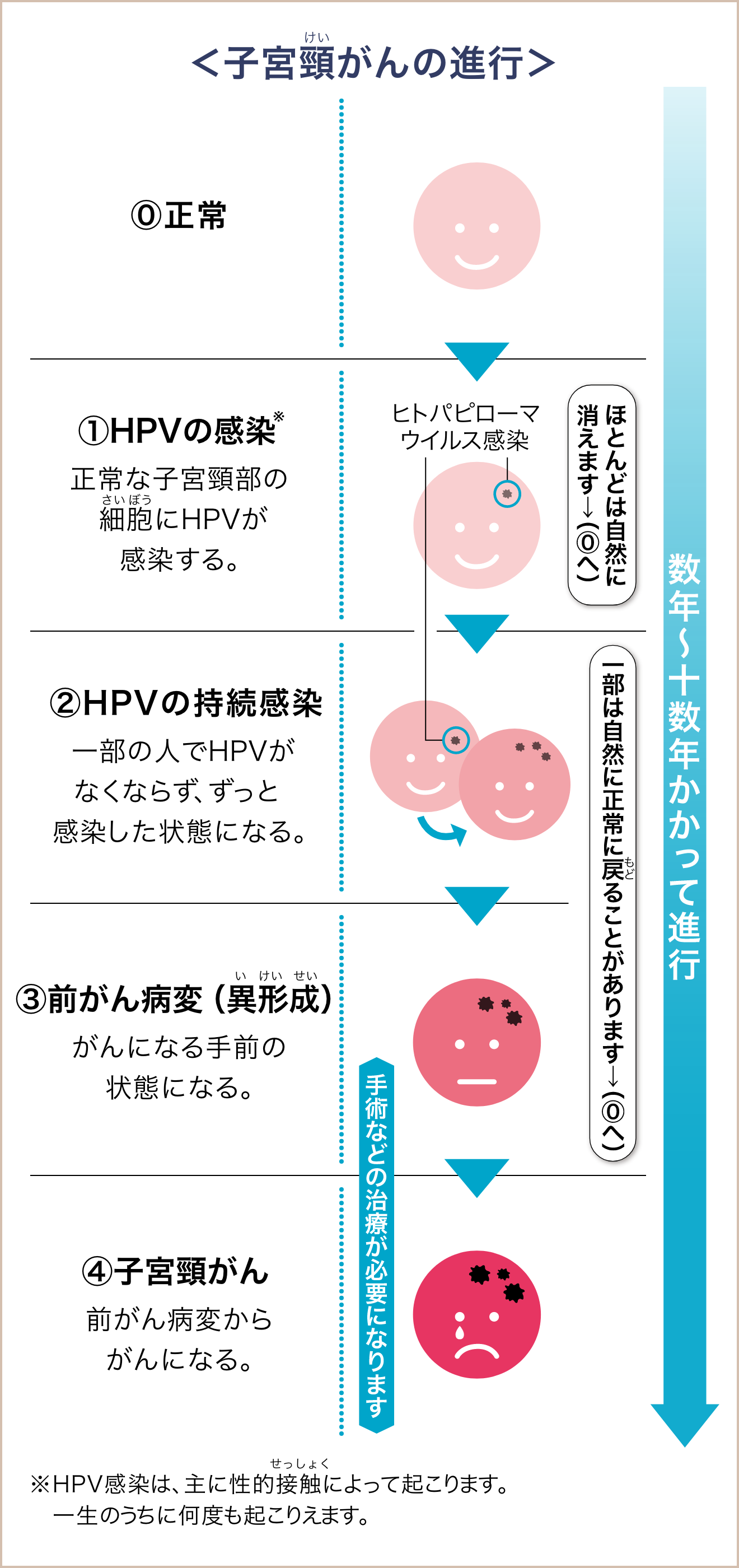 <子宮頸がんの進行>